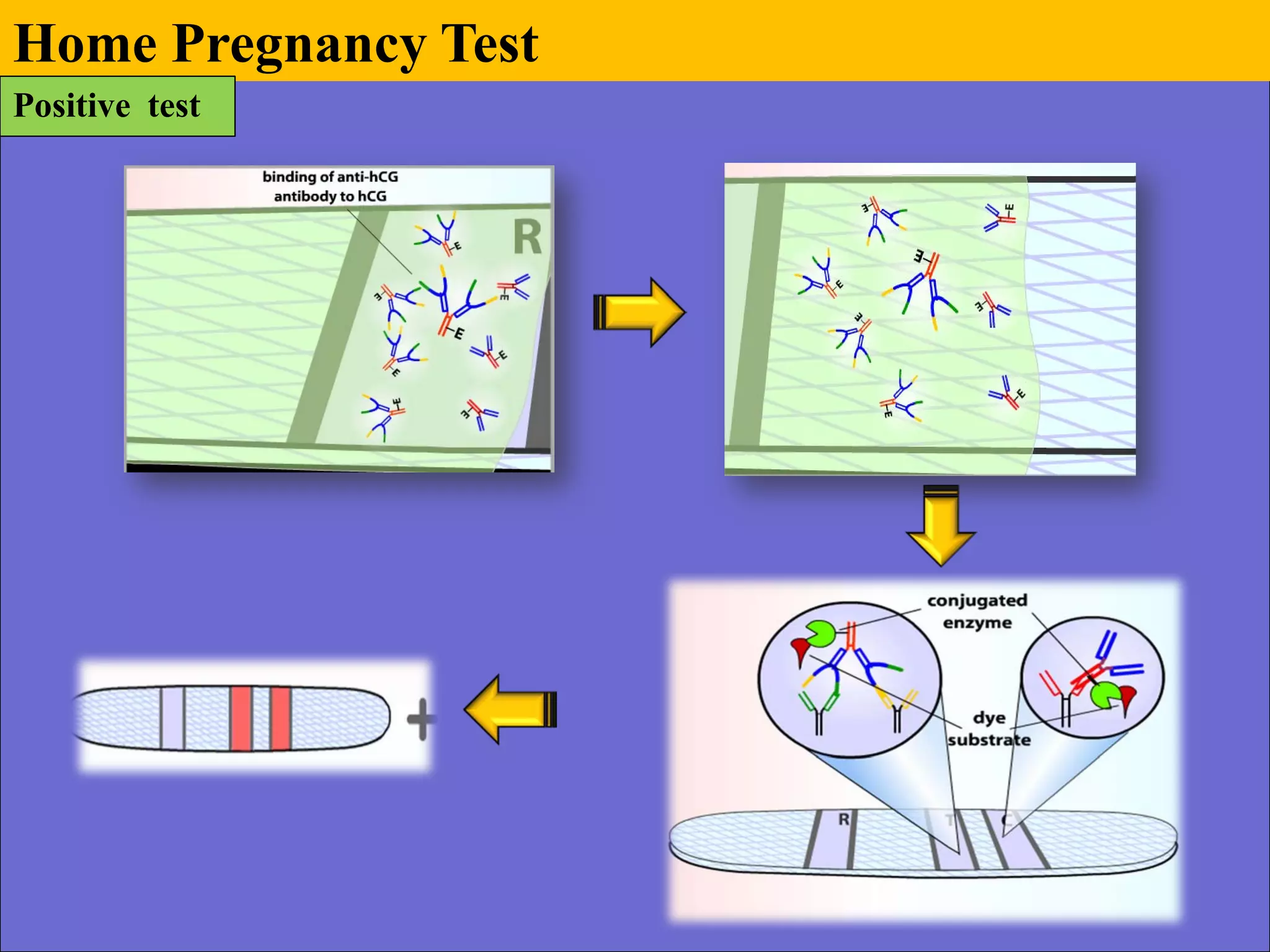 Home Pregnancy Test
Positive test
 