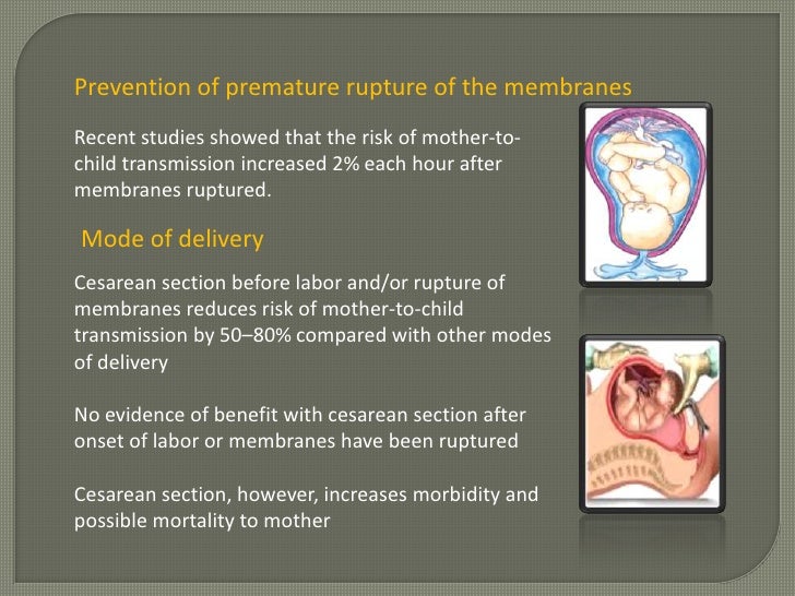 Prevention of parent to child transmission programme