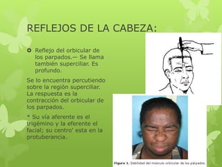 REFLEJOS DE LA CABEZA:
 Reflejo del orbicular de
los parpados.— Se llama
también superciliar. Es
profundo.
Se lo encuentra percutiendo
sobre la región superciliar.
La respuesta es la
contracción del orbicular de
los parpados.
* Su vía aferente es el
trigémino y la eferente el
facial; su centro' esta en la
protuberancia.
 