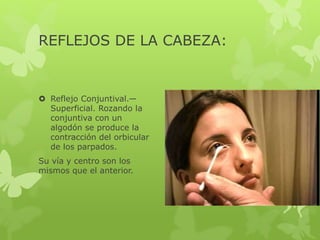 REFLEJOS DE LA CABEZA:
 Reflejo Conjuntival.—
Superficial. Rozando la
conjuntiva con un
algodón se produce la
contracción del orbicular
de los parpados.
Su vía y centro son los
mismos que el anterior.
 