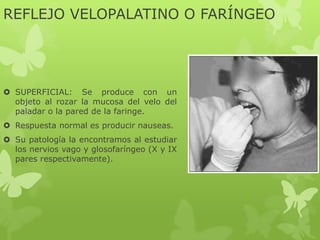 REFLEJO VELOPALATINO O FARÍNGEO
 SUPERFICIAL: Se produce con un
objeto al rozar la mucosa del velo del
paladar o la pared de la faringe.
 Respuesta normal es producir nauseas.
 Su patología la encontramos al estudiar
los nervios vago y glosofaríngeo (X y IX
pares respectivamente).
 