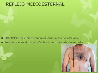 REFLEJO MEDIOESTERNAL
 PROFUNDO: Percutiendo sobre el tercio medio del esternón.
 Respuesta normal contracción de los pectorales de ambos lados.
 