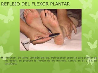 REFLEJO DEL FLEXOR PLANTAR
 Profundo. Se llama también del pie. Percutiendo sobre la cara plantar de
los dedos, se produce la flexión de los mismos. Centro en SI y S2. Es
patológico
 