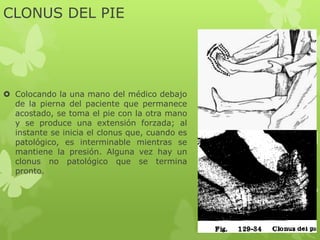 CLONUS DEL PIE
 Colocando la una mano del médico debajo
de la pierna del paciente que permanece
acostado, se toma el pie con la otra mano
y se produce una extensión forzada; al
instante se inicia el clonus que, cuando es
patológico, es interminable mientras se
mantiene la presión. Alguna vez hay un
clonus no patológico que se termina
pronto.
 