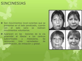 SINCINESIAS
 Son movimientos incon-scientes que se
presentan en el lado paralizado, cuando
con el lado sano se realizan
movimientos voluntarios.
 Aparecen en las lesiones de la vía
piramidal al liberar a los centros
subcorticales y medulares. Se
reconocen tres variedades: de
coordinación, de imitación y global.
 