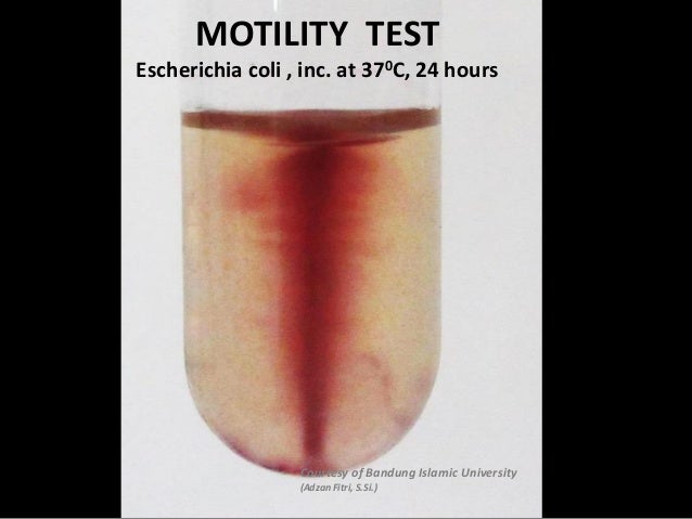 Motility test for e.coli (UNISBA - Indonesia)