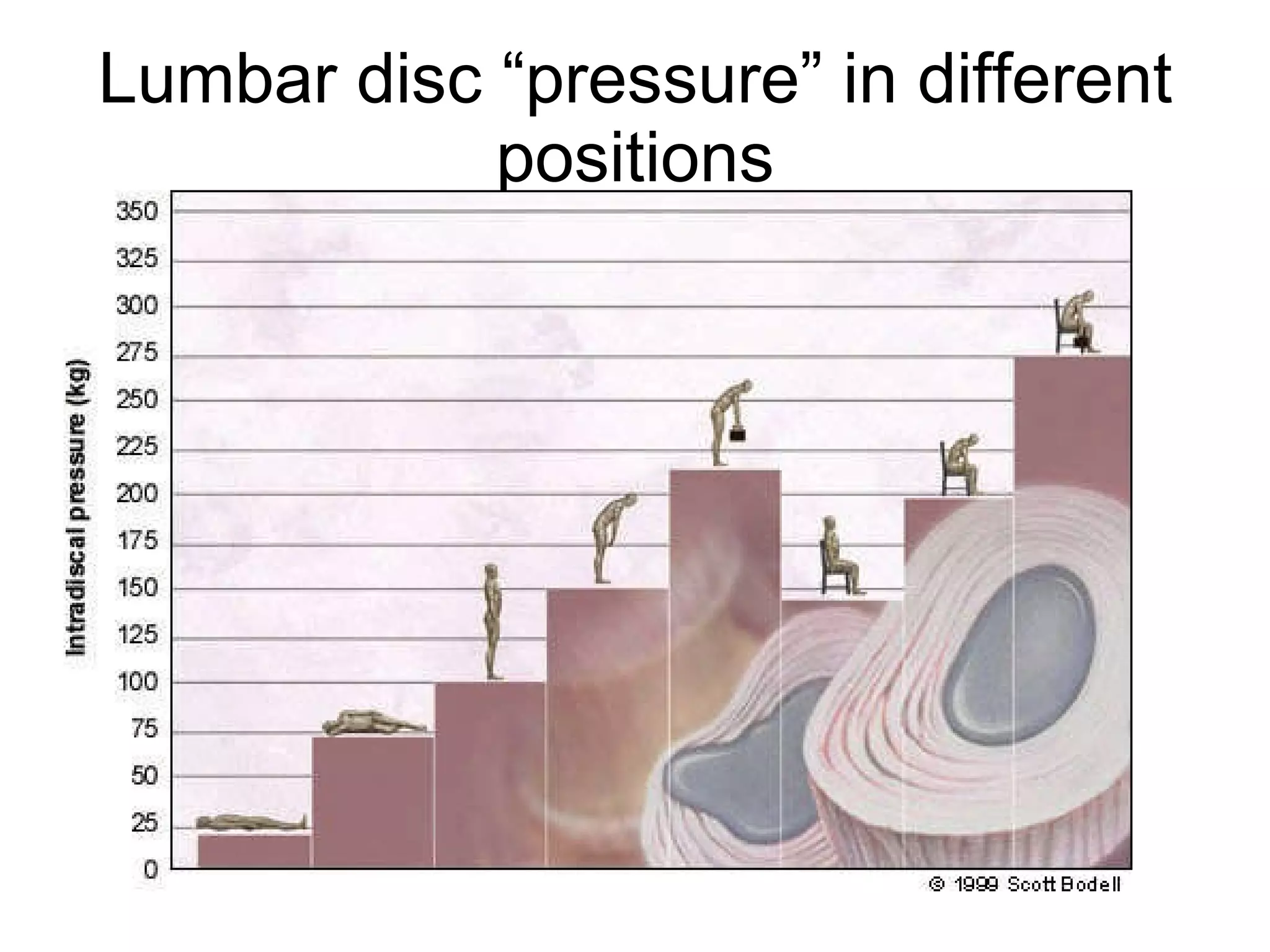 Lumbar disc “pressure” in different positions 