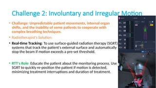 Motion Management radiotherapy RTT prospective | PPTX