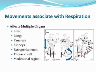 Motion management in Radiation Oncology - 2020 | PPTX