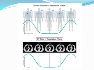 Motion management in Radiation Oncology - 2020 | PPTX