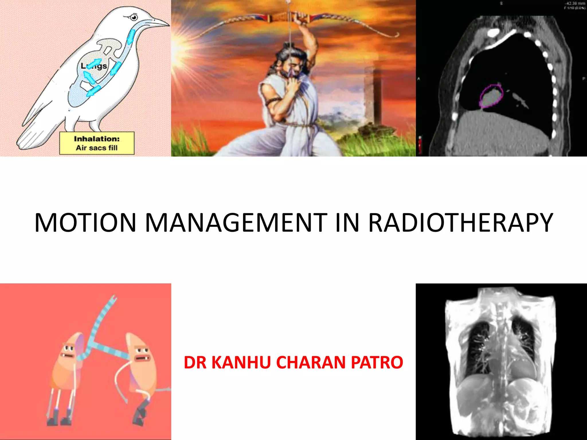 MOTION MANAGEMENT IN RADIOTHERAPY | PPTX