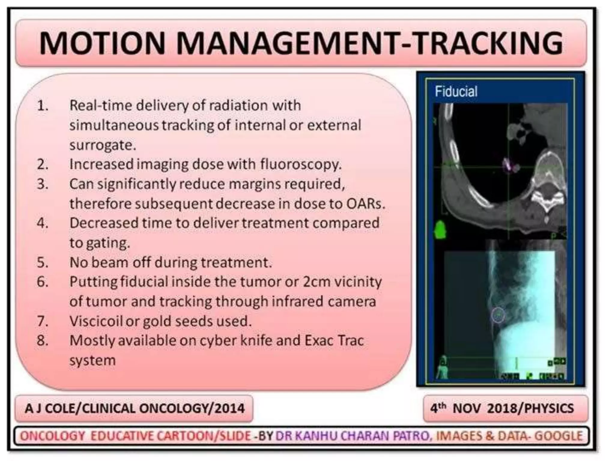 MOTION MANAGEMENT IN RADIOTHERAPY | PPTX