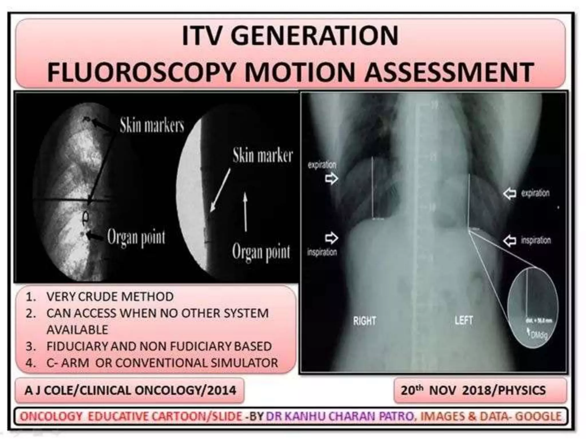 MOTION MANAGEMENT IN RADIOTHERAPY | PPTX