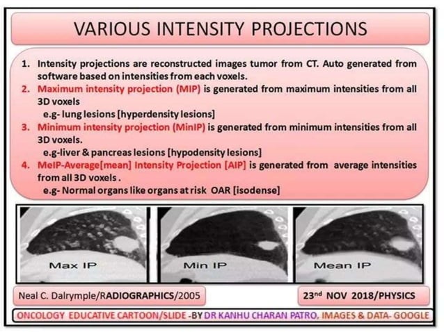 MOTION MANAGEMENT IN RADIOTHERAPY | PPTX | Lung and Respiratory Health ...