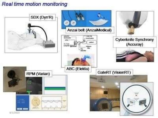 MOTION MANAGEMENT IN RADIOTHERAPY | PPTX | Lung and Respiratory Health ...