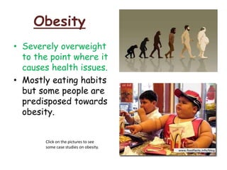 Obesity
• Severely overweight
to the point where it
causes health issues.
• Mostly eating habits
but some people are
predisposed towards
obesity.
Click on the pictures to see
some case studies on obesity.
 