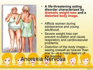 Anorexia Nervosa
• A life-threatening eating
disorder characterized by
dramatic weight loss and a
distorted body image.
• Afflicts women during
adolescence and young
adulthood.
• Severe weight loss can
prevent ovulation and cause
respiratory and cardiovascular
problems.
• Distortion of the body image—
seeing oneself as heavier than
one is—is a major feature of
the disorder.
 