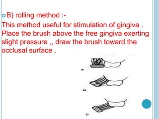 B) rolling method :-
This method useful for stimulation of gingiva .
Place the brush above the free gingiva exerting
slight pressure ,, draw the brush toward the
occlusal surface .
 