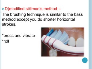 D)modified stillman’s method :-
The brushing technique is similar to the bass
method except you do shorter horizontal
strokes.
*press and vibrate
*roll
 