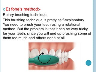 E) fone’s method:-
Rotary brushing technique
This brushing technique is pretty self-explanatory.
You need to brush your teeth using a rotational
method. But the problem is that it can be very tricky
for your teeth, since you will end up brushing some of
them too much and others none at all.
 