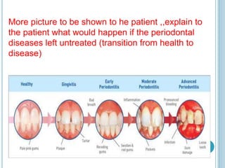 More picture to be shown to he patient ,,explain to
the patient what would happen if the periodontal
diseases left untreated (transition from health to
disease)
 