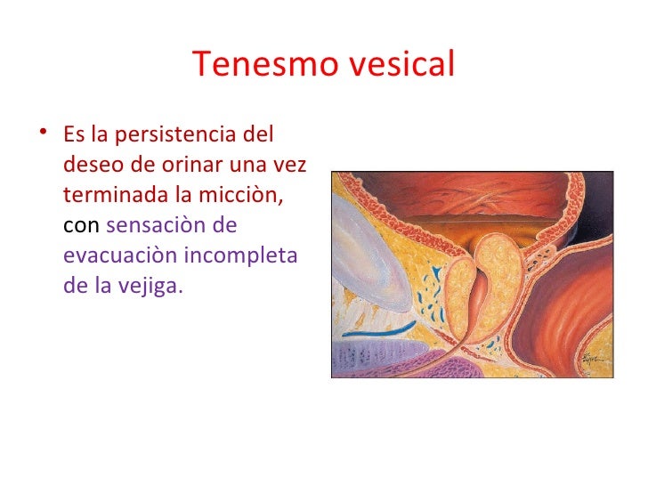 Motivos de consulta nefrourològicos Motivos de consulta nefrourològicos