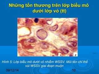 Những tổn thương ttrrêênn llớớpp bbiiểểuu mmôô 
ddưướớii llớớpp vvỏỏ ((tttt)) 
Hình 5: Lớp biễu mô dướI vỏ nhiễm WSSV. Mũi tên chỉ thể 
vùi WSSV giai đoạn muộn 
09/12/14 10 
 