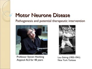 Motor Neurone DiseaseMotor Neurone Disease
Pathogenesis and potential therapeutic intervention
Professor Steven Hawking
Atypical ALS for 48 years
Lou Gehrig (1903-1941)
New York Yankees
 