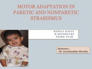 K O P I L A K A F L E
B . O P T O M E T R Y
T H I R D Y E A R
MOTOR ADAPTATION IN
PARETIC AND NONPARETIC
STRABISMUS
Moderator :
Mr. Gaurishankhar Shrestha
 