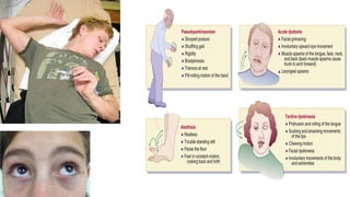 motor disorders.pptx, psychopatholgy, motor movement abnormalities | PPTX