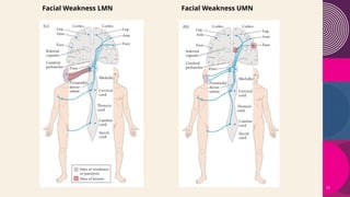 Motor dysfunction Tutorial for Undergraduates.pptx