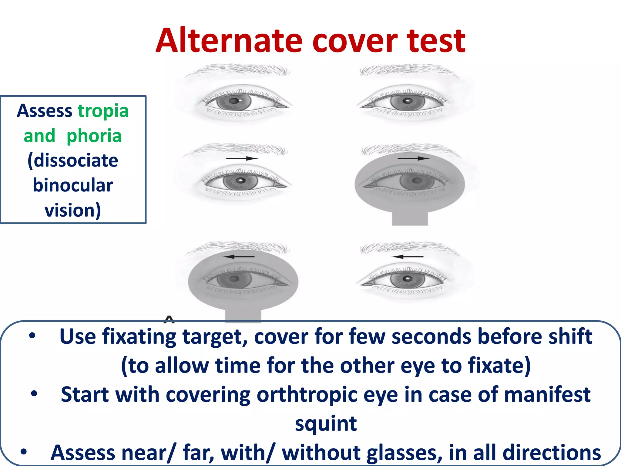 Alternate cover test
• Use fixating target, cover for few seconds before shift
(to allow time for the other eye to fixate)
• Start with covering orthtropic eye in case of manifest
squint
• Assess near/ far, with/ without glasses, in all directions
Assess tropia
and phoria
(dissociate
binocular
vision)
 