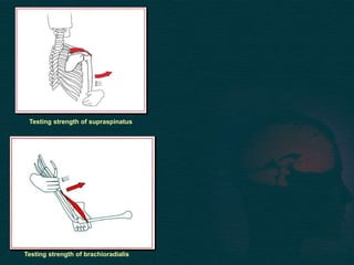 Testing strength of supraspinatus
Testing strength of brachioradialis
 