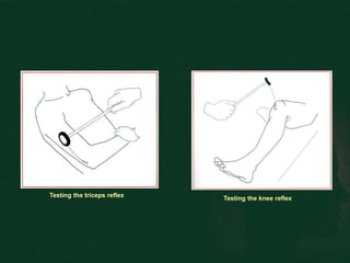 Testing the triceps reflex Testing the knee reflex
 