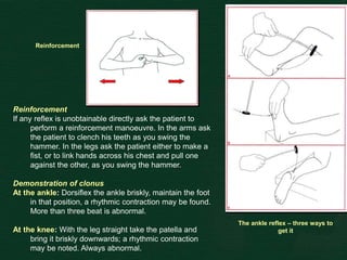 The ankle reflex – three ways to
get it
Reinforcement
If any reflex is unobtainable directly ask the patient to
perform a reinforcement manoeuvre. In the arms ask
the patient to clench his teeth as you swing the
hammer. In the legs ask the patient either to make a
fist, or to link hands across his chest and pull one
against the other, as you swing the hammer.
Demonstration of clonus
At the ankle: Dorsiflex the ankle briskly, maintain the foot
in that position, a rhythmic contraction may be found.
More than three beat is abnormal.
At the knee: With the leg straight take the patella and
bring it briskly downwards; a rhythmic contraction
may be noted. Always abnormal.
Reinforcement
 