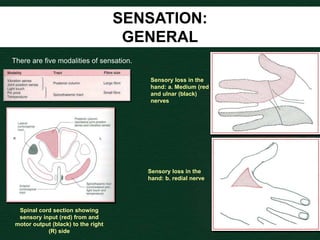 SENSATION:
GENERAL
There are five modalities of sensation.
Spinal cord section showing
sensory input (red) from and
motor output (black) to the right
(R) side
Sensory loss in the
hand: a. Medium (red
and ulnar (black)
nerves
Sensory loss in the
hand: b. redial nerve
 