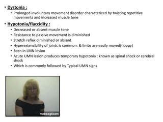 • Dystonia :
• Prolonged involuntary movement disorder characterized by twisting repetitive
movements and increased muscle tone
• Hypotonia/flaccidity :
• Decreased or absent muscle tone
• Resistance to passive movement is diminished
• Stretch reflex diminished or absent
• Hyperextensibility of joints is common. & limbs are easily moved(floppy)
• Seen in LMN lesion
• Acute UMN lesion produces temporary hypotonia : known as spinal shock or cerebral
shock
• Which is commonly followed by Typical UMN signs
 