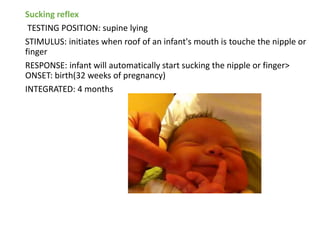 Sucking reflex
TESTING POSITION: supine lying
STIMULUS: initiates when roof of an infant's mouth is touche the nipple or
finger
RESPONSE: infant will automatically start sucking the nipple or finger>
ONSET: birth(32 weeks of pregnancy)
INTEGRATED: 4 months
 