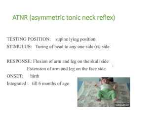 ATNR (asymmetric tonic neck reflex)
 