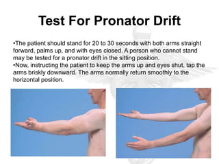 Pronator Rift Motor System Examination | PPTX