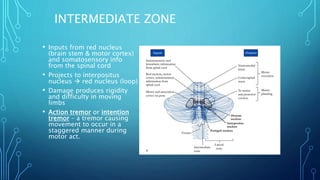 INTERMEDIATE ZONE 
• Inputs from red nucleus 
(brain stem & motor cortex) 
and somatosensory info 
from the spinal cord 
• Projects to interpositus 
nucleus  red nucleus (loop) 
• Damage produces rigidity 
and difficulty in moving 
limbs 
• Action tremor or intention 
tremor – a tremor causing 
movement to occur in a 
staggered manner during 
motor act. 
 