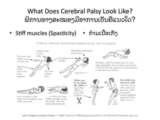 Including Children with Motor Impairments