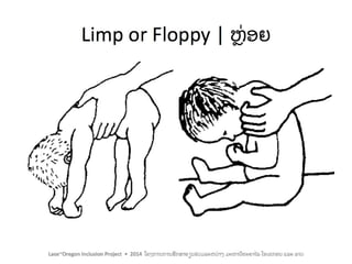 Including Children with Motor Impairments