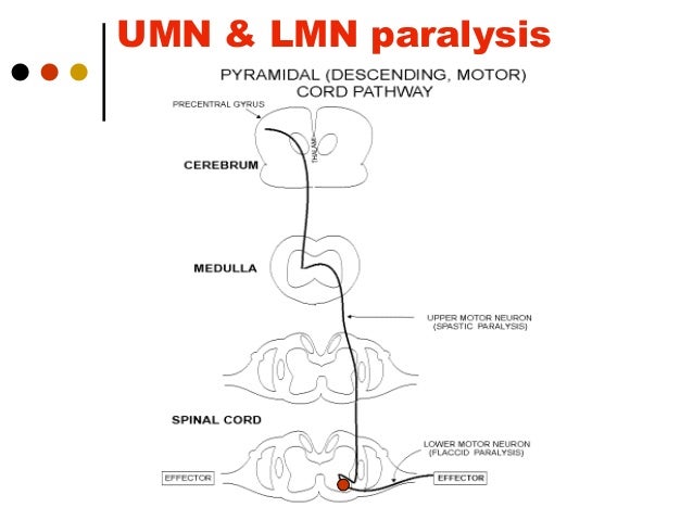 upper motor neuron lesion