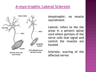 A-myo-trophic Lateral Sclerosis

                  Amyotrophic: no muscle
                  nourishment

                  Lateral: refers to the the
                  areas in a person's spinal
                  cord where portions of the
                  nerve cells that signal and
                  control the muscles are
                  located

                  Sclerosis: scarring of the
                  affected nerves
 