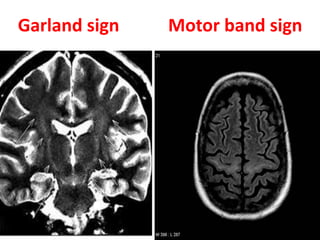 Garland sign Motor band sign
 