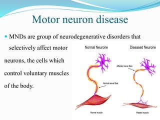 Motor neuron disease
 MNDs are group of neurodegenerative disorders that
selectively affect motor
neurons, the cells which
control voluntary muscles
of the body.
 