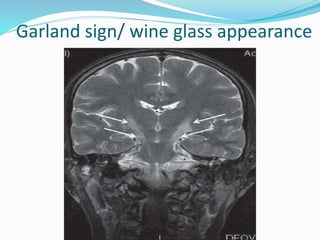 Garland sign/ wine glass appearance
 