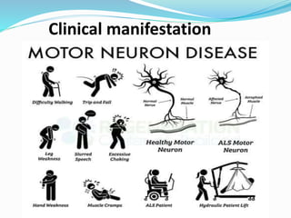 Clinical manifestation
 