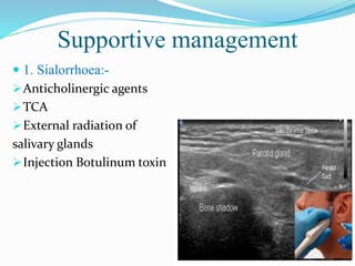 Supportive management
 1. Sialorrhoea:-
Anticholinergic agents
TCA
External radiation of
salivary glands
Injection Botulinum toxin
 